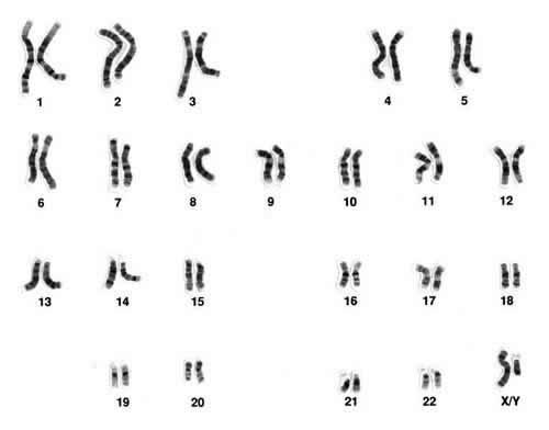 Image of 23 chromosomes